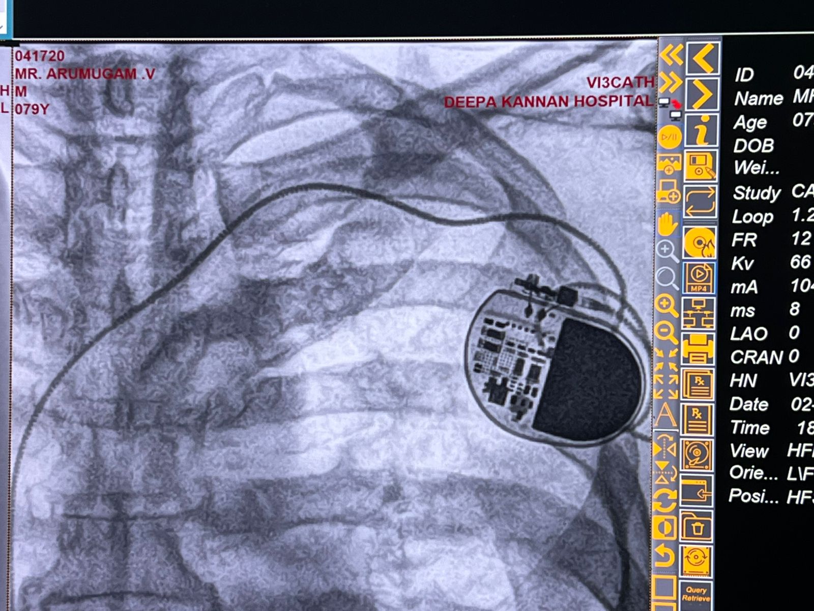 Medical Angiogram Image 6